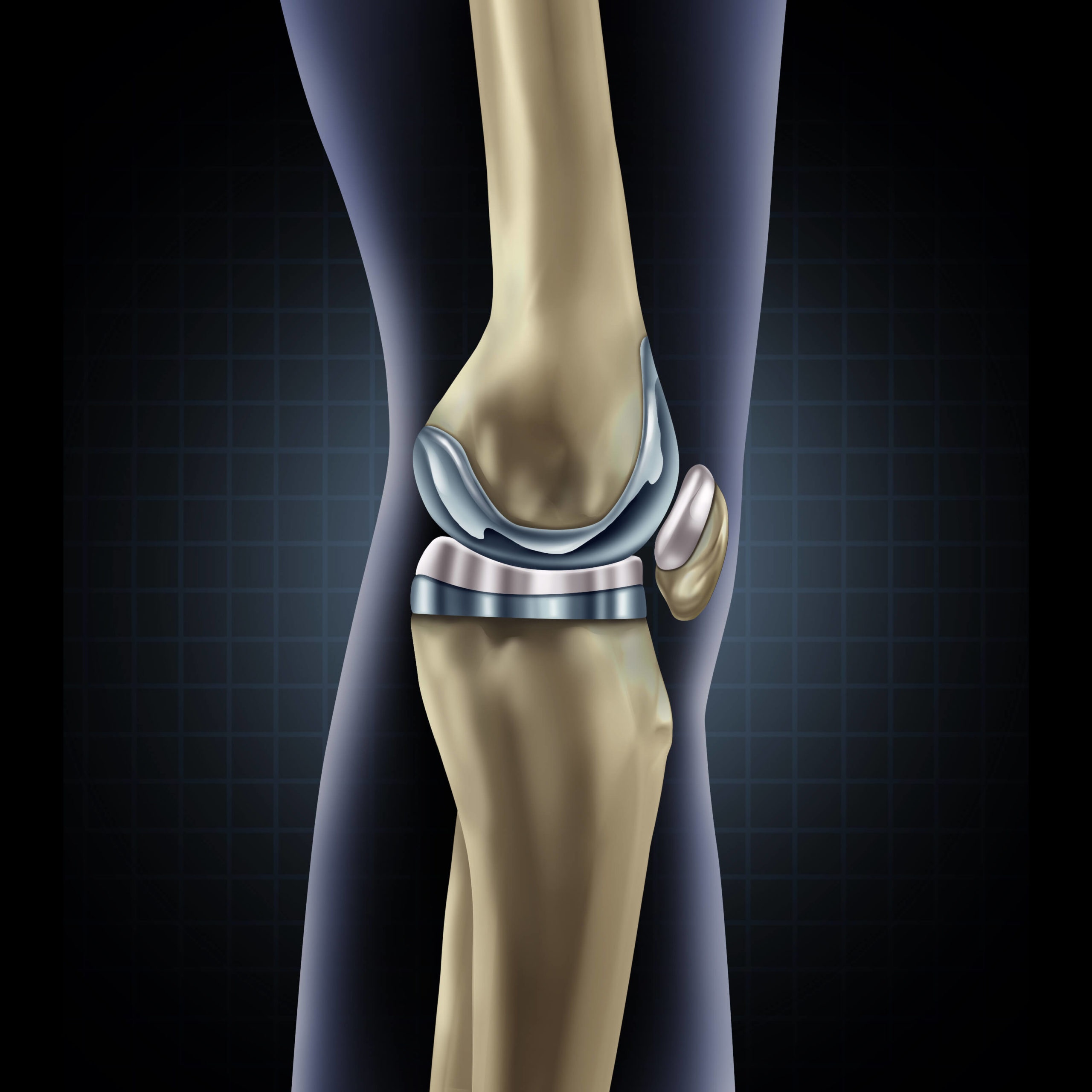 Photograph of the knee joint